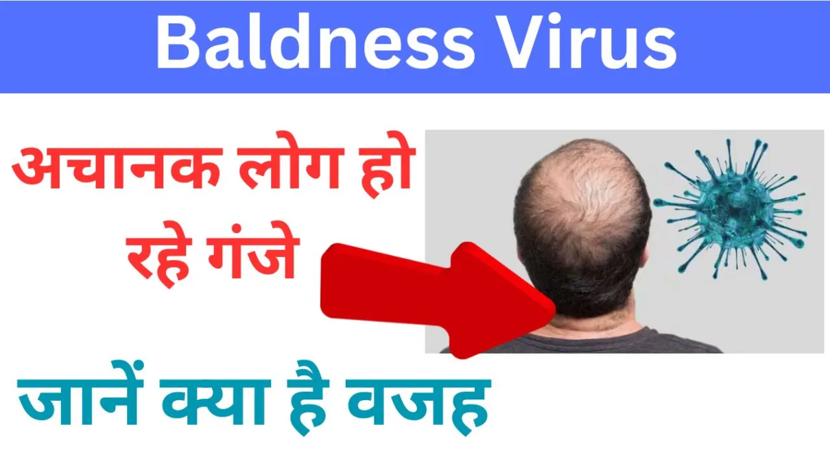 Baldness Virus: अचानक लोग हो रहे गंजे, जानें क्या है वजह 1 Baldness Virus